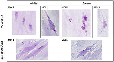 Mycobacterium canettii Infection of Adipose Tissues